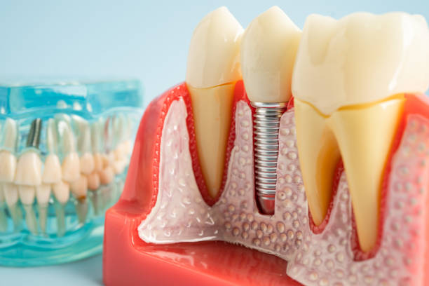 Best Dental Exams and Cleanings  in Arlington, NY